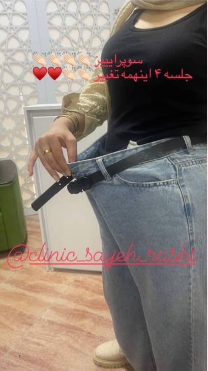 کلینیک پزشکی و زیبایی پوست مو سایه در نواب رشت